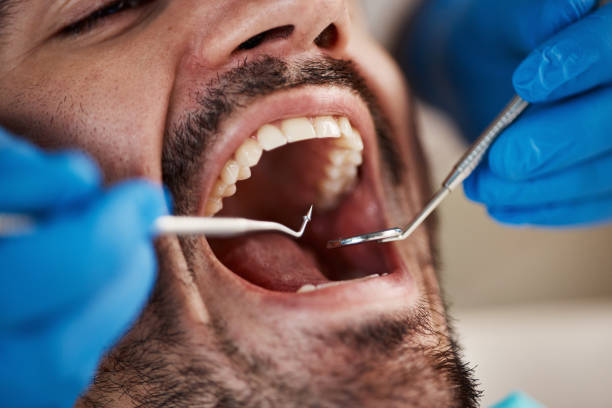 Best Emergency Dental Care for Sports Injuries in Tucumcari, NM